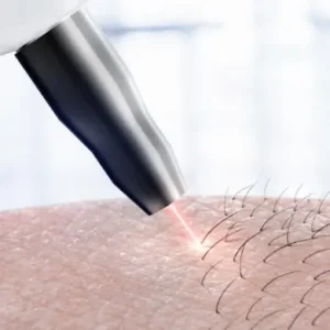 معایب استفاده از ژل مخصوص لیزر