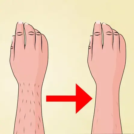 چه کسانی نباید لیزرکنند؟