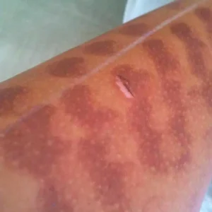 تاثیر ژل خنک کننده بر لکه ها
