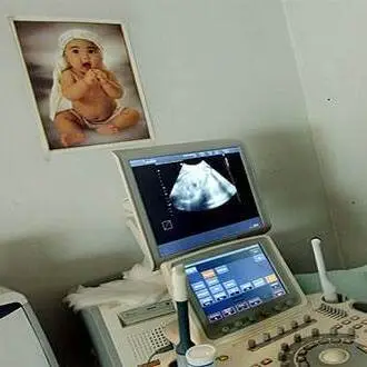 سونوگرافی مادر باردار