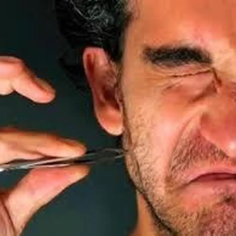 کندن موی زائد بدن با موچین