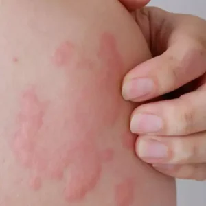 عدم حساسیت زایی ژل سونوگرافی خوب
