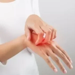 سوزش و خارش بعد از لیزر موی زائد